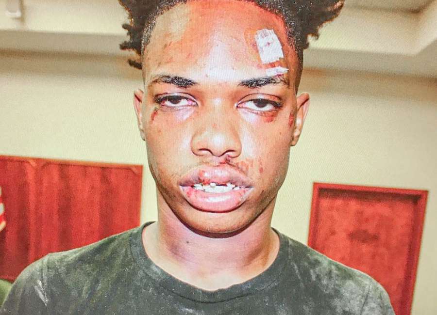 Beating victim, accused child molester released on bond