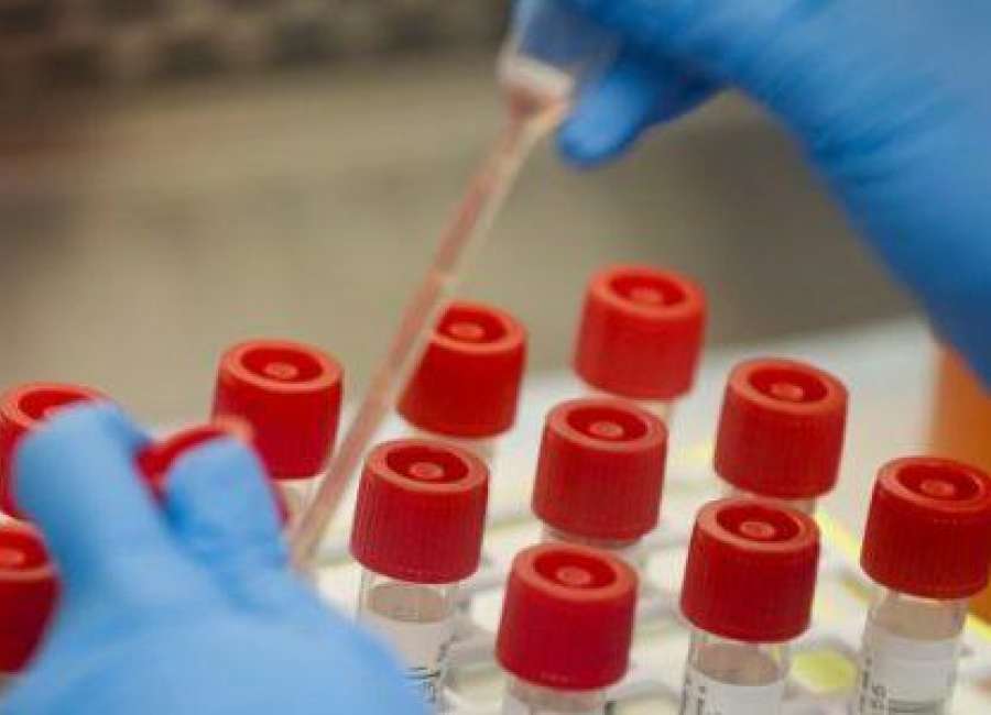 Kemp links COVID jump to lab backlog, lifts more state restrictions