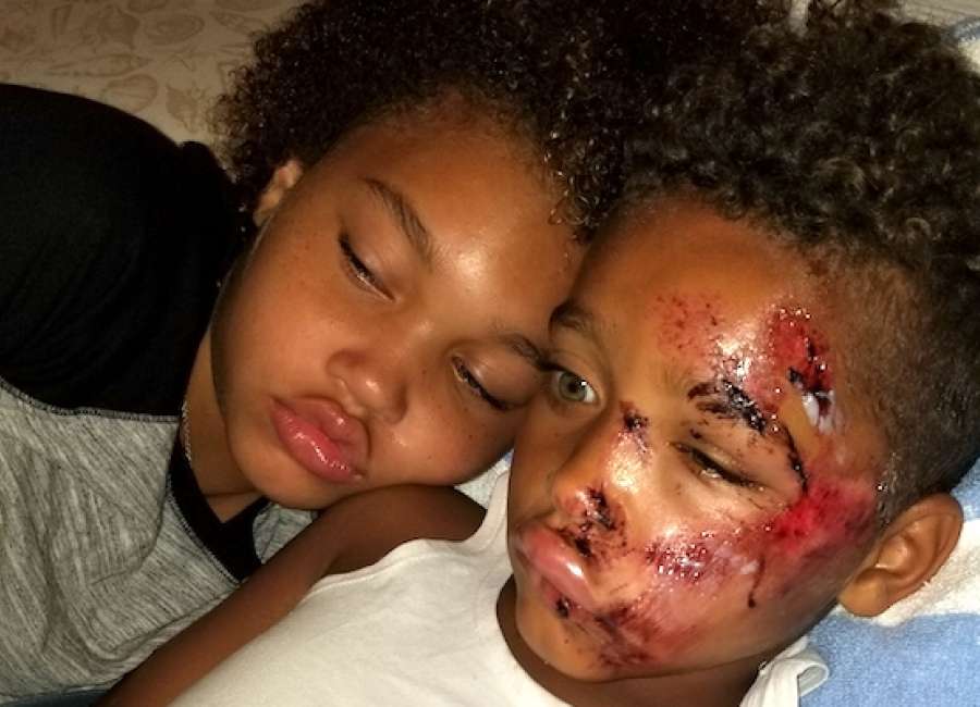 Sister jumps in to help little brother after bike crash